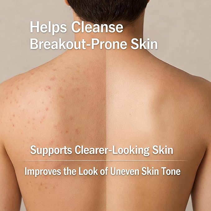Men's Acne Body Wash, Acid Body Wash for Back, Chest & Shoulders, with Niacinamide, Glycolic Acid & Ceramides, 8.5 fl oz