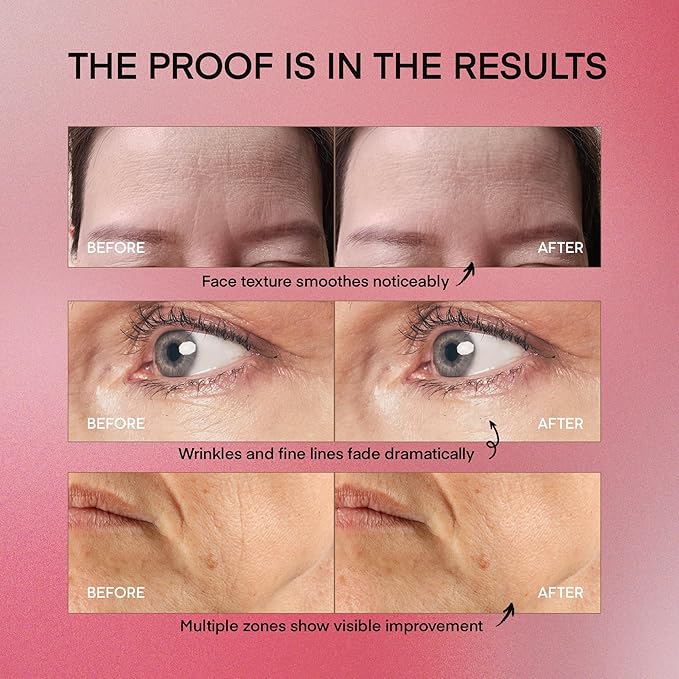 VELAMO ADVANCED Retinol Face Stick – Reduces Fine Lines, Wrinkles & Uneven Texture in 4–8 Weeks – For Mature Skin, Women & Men – 0.28 OZ/8g