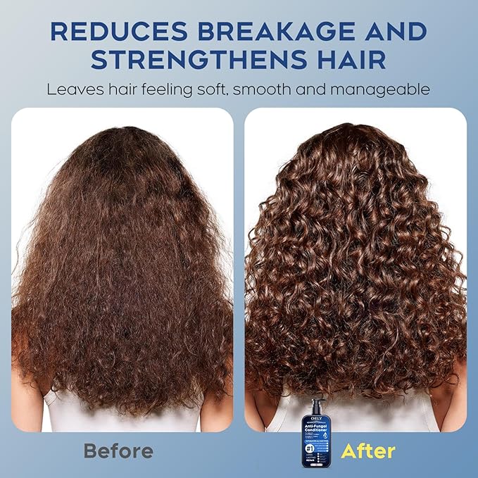 Deep Moisturizing & Folliculitis Conditioner: With Mint & Tea Tree Oil, Hydrates Dry Hair, Strengthens & Repairs Damaged, Brittle Hair, Boosts Shine, Sulfate-Free, for All Hair Types - 10.14 fl.oz