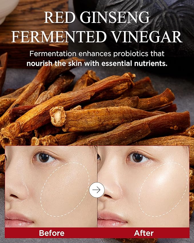 Danahan Korean Red Ginseng Eye Cream for Dark Circles, Puffiness & Fine Lines - Anti-Aging Hydrating Under Eye Cream with 6-Year Fermented Ginseng Vinegar, Bonyongo Hanbang, 1.01 fl oz/30ml