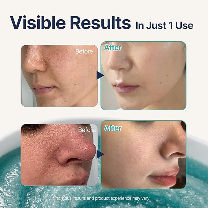 Saunan Heating Salt Mask | Self-Warming Wash Off Mask for Pore Tightening & Sebum Softening | 13% Salt, Birch Sap & Blueberry Extract | Gentle Exfoliation | Korean Skin Care (3.17 fl oz)