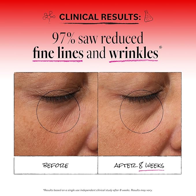 Derma E Anti-Wrinkle Smoothing Eye Cream for Fine Lines and Crow's Feet, 0.5 Fl Oz, Anti Aging with Retinol, Caffeine and Antioxidants, Cooling Tip Helps Reduce Puffiness