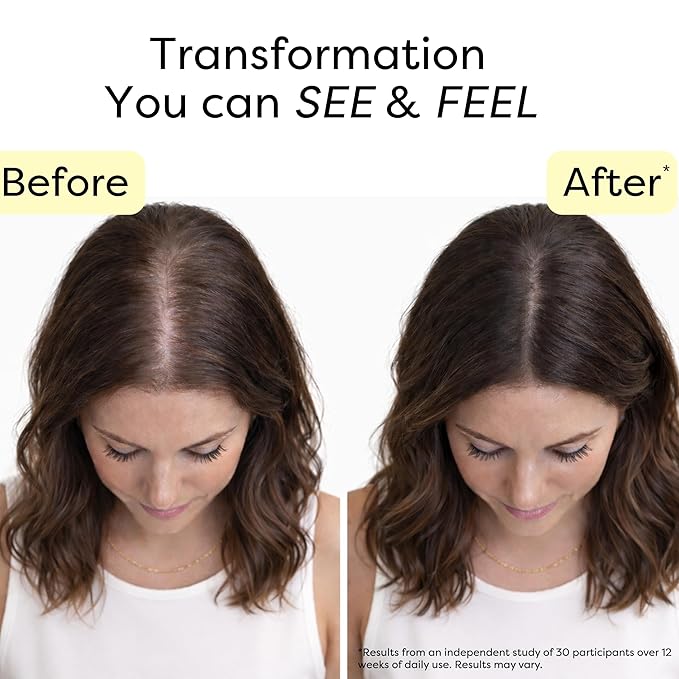 Hair Growth Serum - Water Based Scalp Treatment for Thinning Hair | Caffeine, Peptides, Rosemary & Turmeric | Promotes Thicker, Fuller Looking Hair & Healthy Scalp for Women & Men 2 fl oz