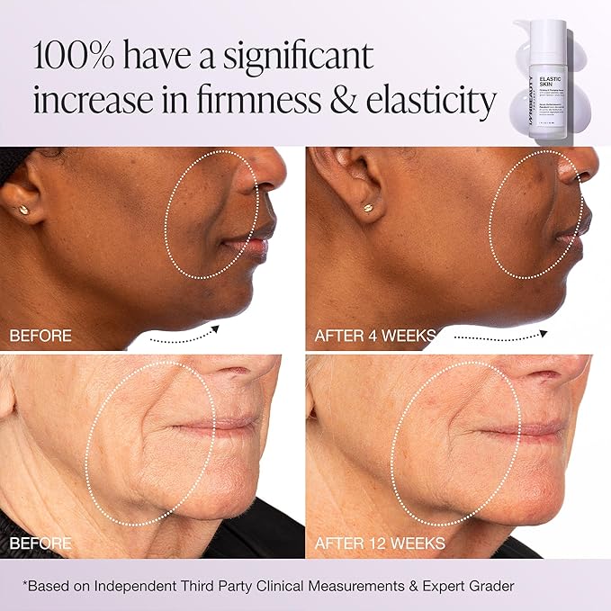 INNBEAUTY Project Elastic Skin Firming & Plumping Growth Factor Serum with Copper Peptides, 1 OZ (30ml)