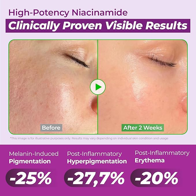 JUMISO 20% Niacinamide Dark Spot Serum 2-Pack – TXA + Glutathione Brightening Face Serum Value Set – Pore Care, Glass Skin Finish – Fast-Absorbing, Centella Soothing, Sensitive Skin Safe, 1.35 fl ozx2