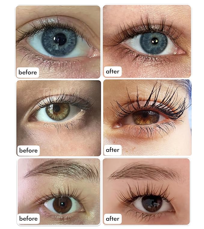 TOPLASH XL Lash and Brow Booster, Growth Serum with Eyelash and Eyebrow Enhancer, Promotes Stronger, Thicker, Healthier Lashes with Botanicals and Peptides - 0,2 Fl Oz(6 ml)