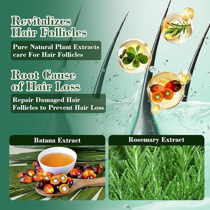 -Promote Hair Growth,Rosemary Shampoo,Nourishes Scalp, Reduces Breakage & Adds Shine,Reduces Hair Loss (Batana Shampoo-(10.1 fl oz))