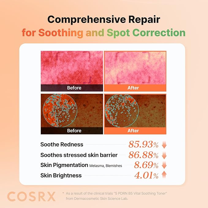 COSRX 5 PDRN B5 Vital Soothing Toner - Korean Toner for Rejuvenating & Soothing Skin with Salmon DNA, Centella, Lactobacillus PDRN & Panthenol, Mothers day gift for Mom, Korean Skin Care 9.46 fl.oz.