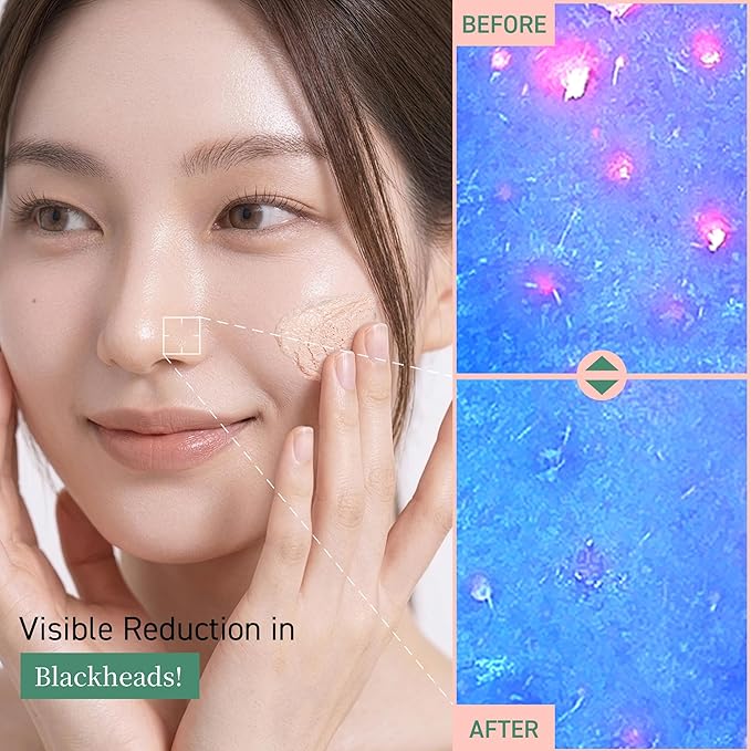 Pink Clay Enzyme Cleanser, Blackhead Remover Powder Cleanser, Deep Pore Cleansing with BHA, Gentle Exfoliating Face Wash, Facial Scrub for Acne-Prone Skin, Korean Skin Care
