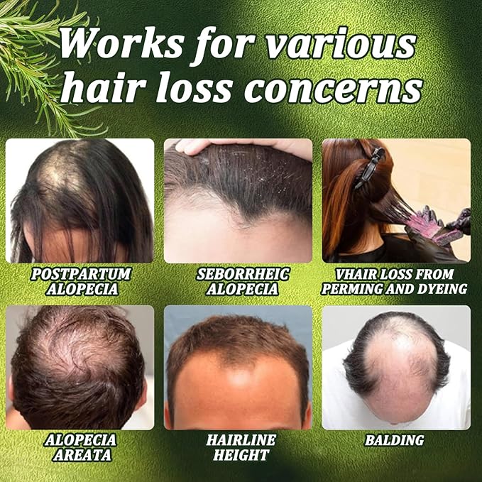 Organic Rosemary Hair Growth Shampoo for Men and Women-Natural Thickening and Strengthening Formula with Biotin Hydrolyzed keratin -Designed for Thinning Hair & Hair Loss 10.15 fl.oz