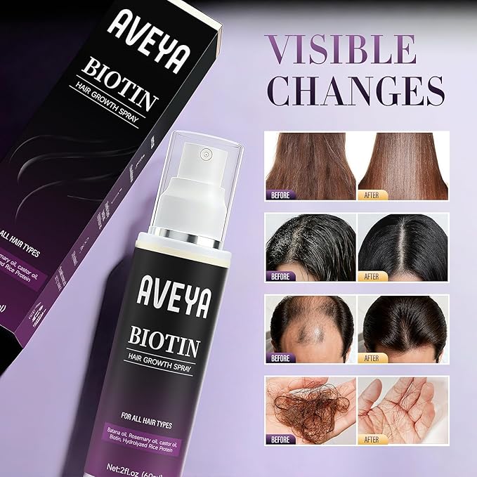 AVEYA Hair Growth Serum, for Women & Men infused with Rosemary Oil,Batana Oil&Biotin for Scalp – Strengthens,Thickens&Accelerates Hair Care - Non-Greasy,Helps Prevent Hair Thinning & Hair Loss – 60ml