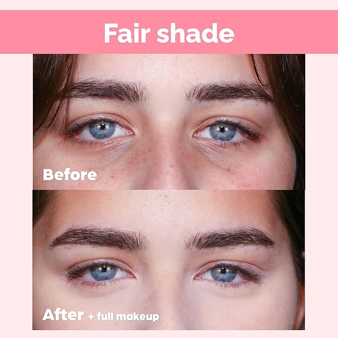 Elizabeth Mott Thank Me Later Under Eye Brightener & Primer – Hydrating Color Corrector and Concealer Primer for Dark Circles – Smooth Base for Mature Skin – Lightweight Formula, Fair Shade 5ml