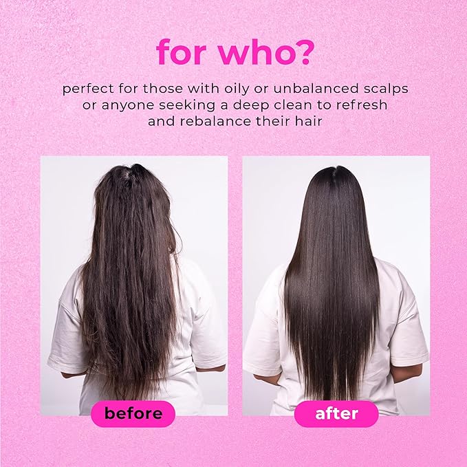 Only4Hair Sea Salt Scrub Shampoo scalp detox treatment
