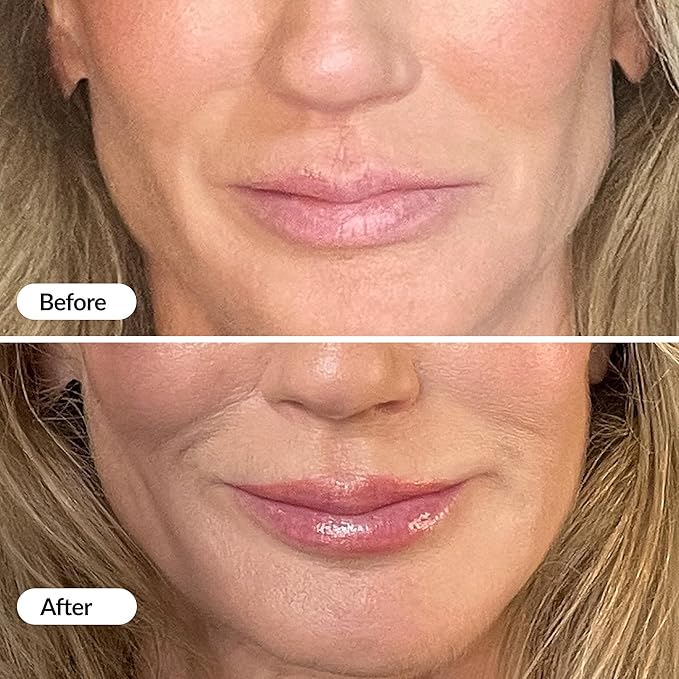 Vibriance Hydrating Lip Volumizer - Plumping Gloss with Hyaluronic Acid - Plumper Smooths Lines and Wrinkles, 0.14 fl oz