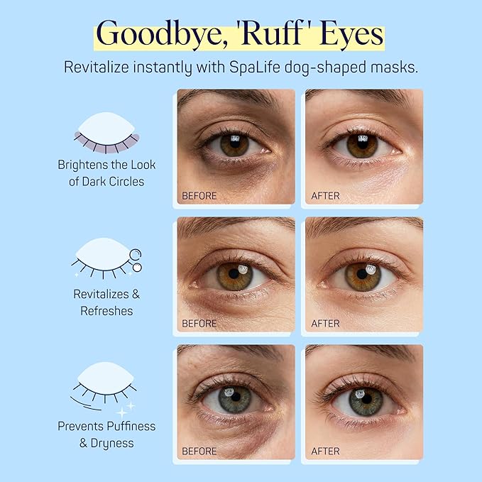 SpaLife Puppy Eyes Corgi Under Eye Patches for Dark Circles | Puppy Under Eye Patches for Puffy Eyes | Radiance Undereye Masks for Bags and Shadows | Pack of 10 Pairs (10 Undereye Treatments)