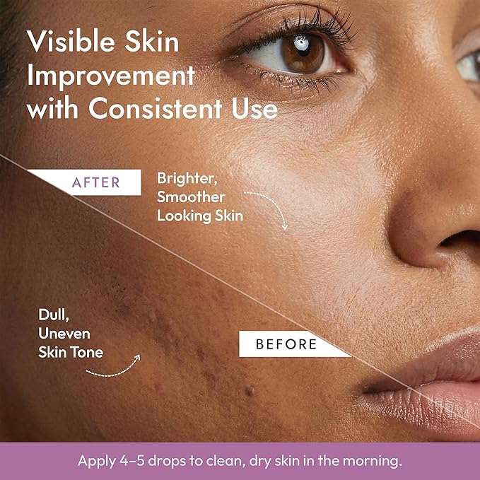 DERMAdoctor Vitamin C Serum For Face 20% Vitamin C, Vitamin-E, Ferulic Acid, Ascorbic Acid Concentrated Dermatologist-Formulated Anti Aging Face Serum, Hydrating & Discoloration - 1.0 fl oz