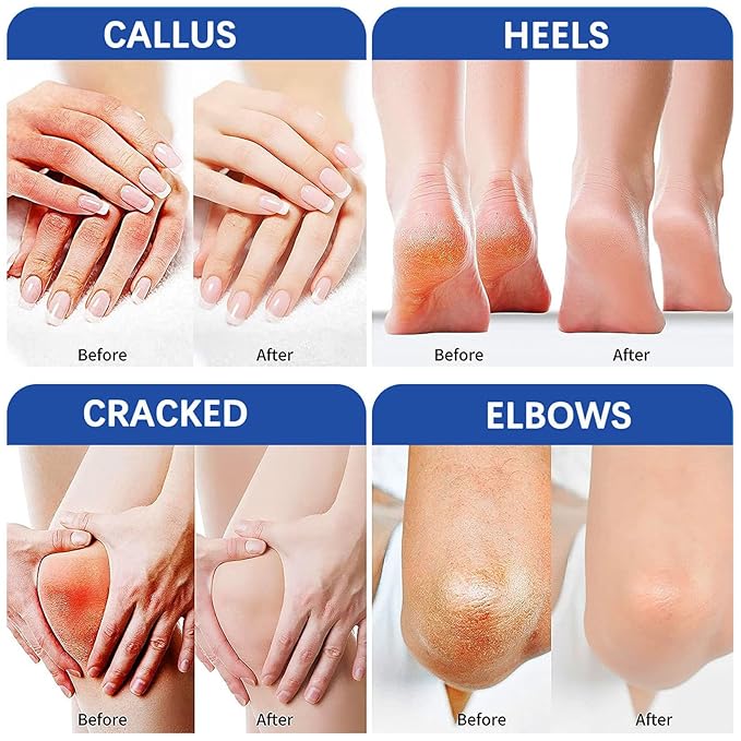 NovaCharm 2PCS Urea Cream 60 Percent for Feet, Maximum Strength Urea Foot Cream Stick, Foot Moisturizer Lotion for Cracked Heels, Dry Hands & Rough Knees (1.4Ounce(Pack of 2), Aloe Vera)