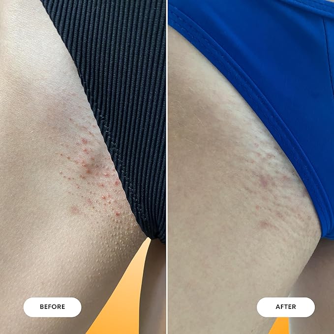 Bushbalm Ingrown Hair and Razor Bumps 2-Step Routine - Moisturize and Calm - Ingrown Hair Oil (30 ml) and Exfoliating Scrub (236 ml) - Vanilla Tangerine