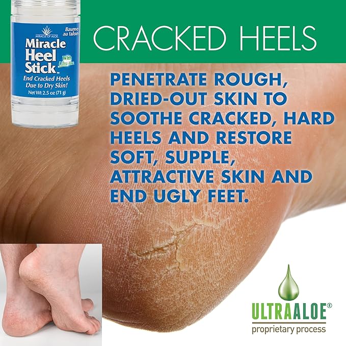 2 Pack - Heel Balm for Dry Cracked Feet - Miracle Heel Stick for Cracked Heel Repair - Cracked Heel Treatment - Formulated with Pure Aloe Vera, Tea Tree Oil, Shea & Cocoa Butters | 2.5 oz