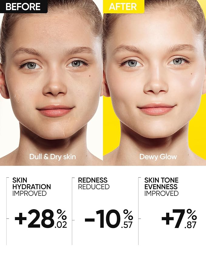 SKINTIFIC Radiance Booster Serum Spray, Hydrating Face Mist with Bifida Ferment & Squalane, Glow Serum for Radiant Skin, Soothes Skin, Vegan Skin Care, All In One Mist 3.3 fl oz