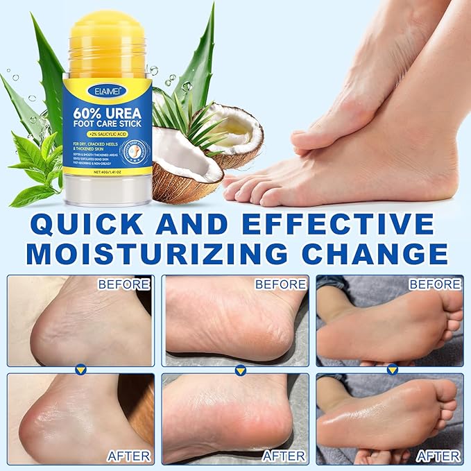 Urea Foot Care Cream, Urea Cream 60 Percent for Feet Maximum Strength with 2% Salicylic Acid, Foot Cream for Cracked Heels and Dry Skin, Cracked Heel Repair, Callus Remover, Deep Hydration, 1.41 Oz