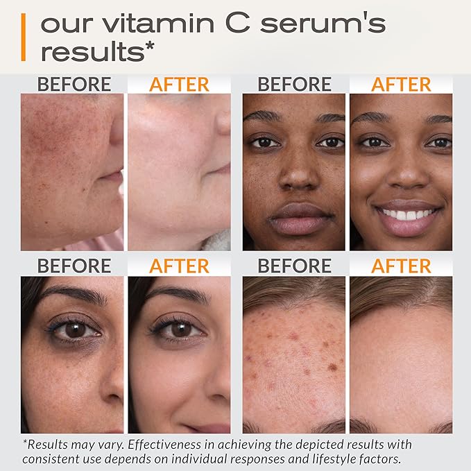 Ella & Eden Vitamin C Serum for Face - Hyaluronic Acid, Aloe Vera, Vitamin E, CoQ10 - Anti-aging, Skin Brightening - USA Made - Paraben-Free, Fragrance-Free, Suitable for All Skin Types - 1 Fl Oz
