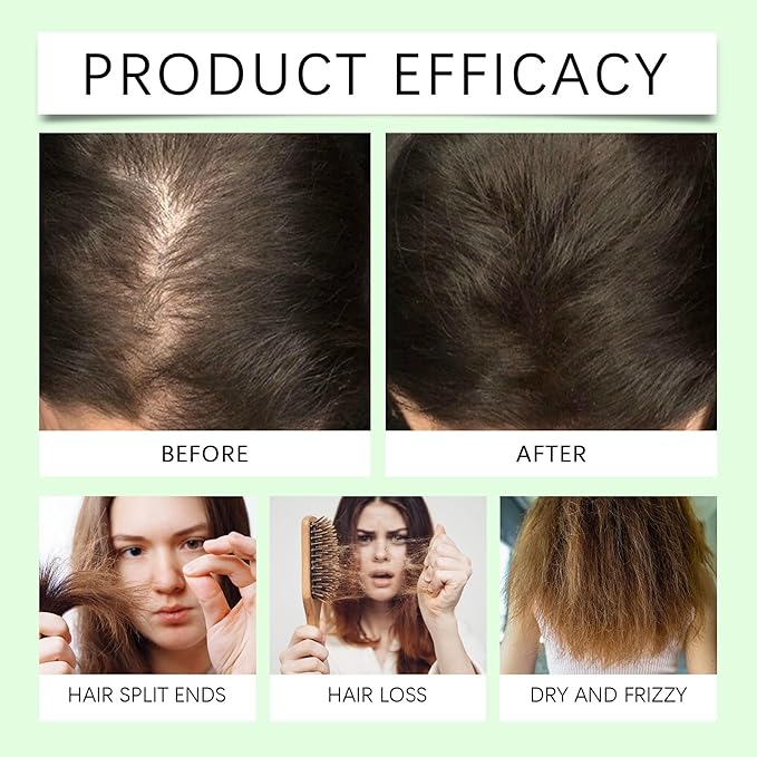 Rosemary Hair Growth Shampoo, Rosemary Hydrolyzed Keratin Shampoo for Thinning Hair and Hair Loss, Nourishes and Regenerates Hair for Women and Men (2Pcs)