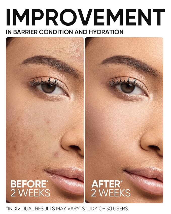 SKINTIFIC 5X Ceramide Barrier Repair Serum for Dry & Sensitive Skin Barrier Repair with Ceramide, Centella and Hyaluronic Acidx, Soothes Sensitive Skin, Reduces Redness & Strengthens Skin Barrier