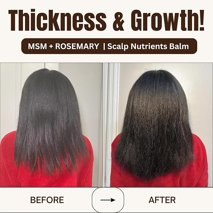 Qhemet Biologics MSM + Rosemary Scalp Nutrients Balm | Food for Hair Growth | MSM, Rosemary, Bhringraj, Castor Oil & Coconut Oil | For Dry Scalp, Thinning & Slow Growth | Vegan (4 oz)