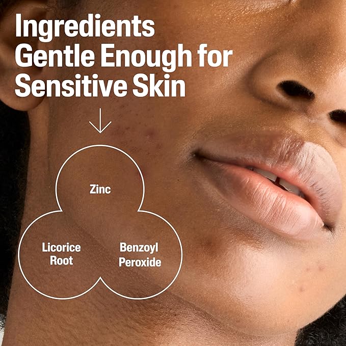 Cetaphil Gentle Clear Complexion-Clearing BPO Acne Cleanser with 2.6% Benzoyl Peroxide, Creamy and Soothing for Sensitive Skin, Suitable for All Skin Types, 4.2oz (Pack of 12)