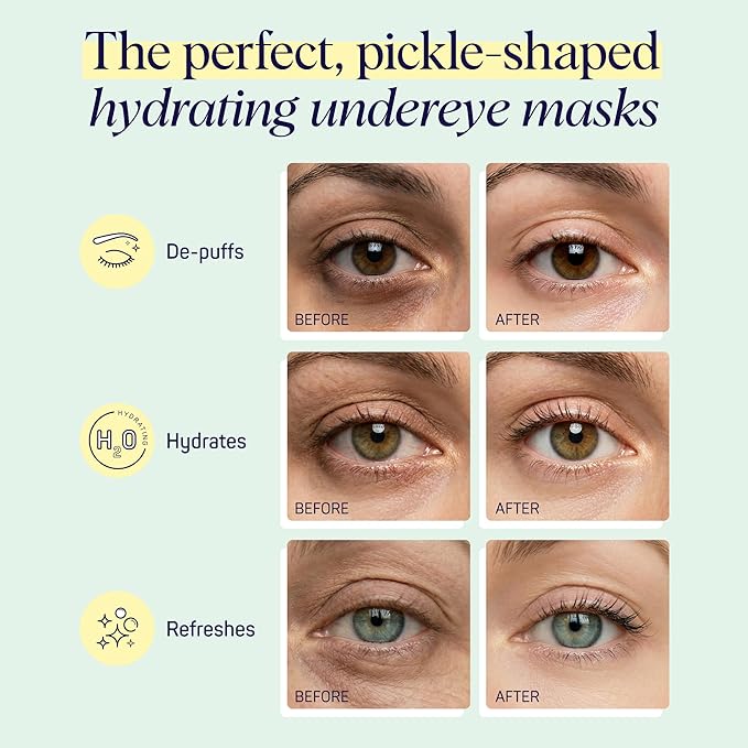 SpaLife In a Pickle Hydrogel Under Eye Patches for Dark Circles | Pickle Under Eye Patches for Puffy Eyes | Hydrating Undereye Masks for Bags and Puffiness | Pack of 8 Pairs (8 Undereye Treatments)