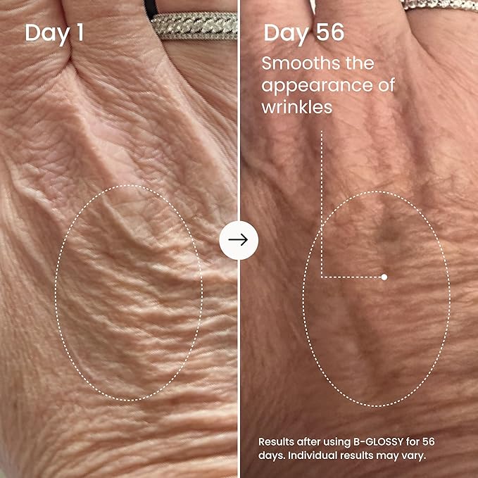 MAËLYS B-GLOSSY Hyaluronic Acid Body Serum - Firming & Hydrating Body Serum for Crepey Skin - Peptides + Meadowfoam - Helps Smooth Look of Wrinkles & Aging Skin - Lightweight Firming Serum (2 Pack)