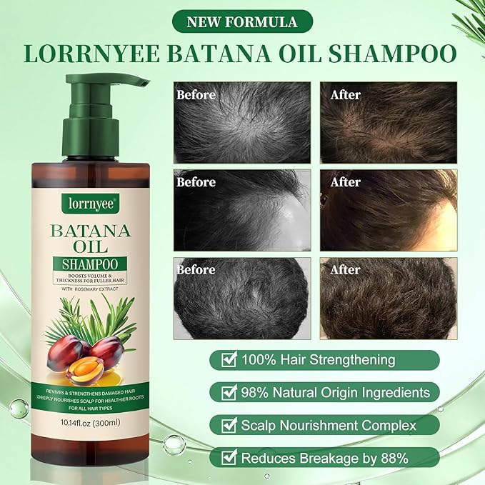 Batana Oil Shampoo, Hair Growth Shampoo for Thinning Hair & Hair Loss Treatment - Organic Rosemary, Formula with Biotin & Keratin to Reduce Shedding, Thicken Hair For Men & Women 2 Pack