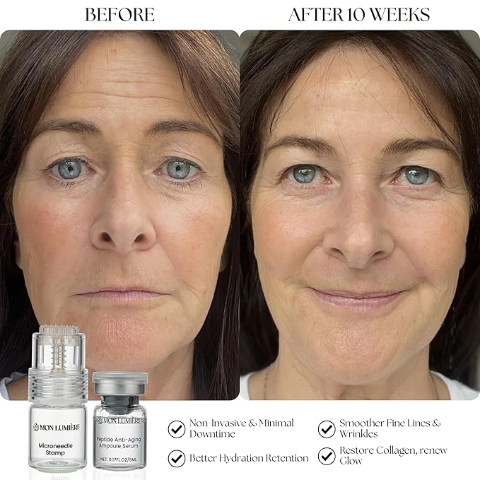 Mon Lumiere Micro Infusion System for Face – Gold Spring-Loaded Facial Stamp with PDRN & Peptides – At-Home Skincare Kit for Glow, Smoother-Looking Skin & Visible Radiance – 3 Single-Dose Serums