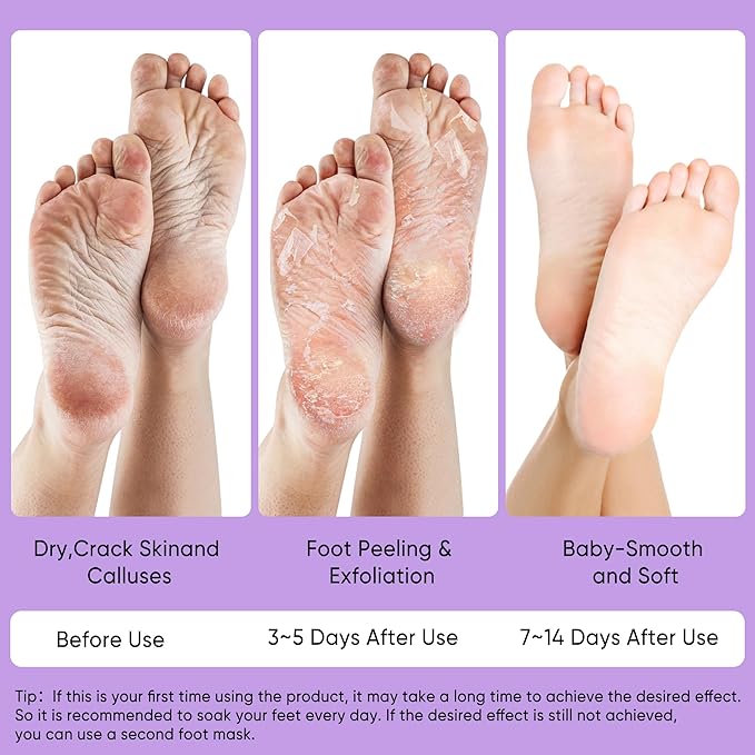 Foot Peeling Mask, Callus Remover Exfoliating Feet Mask Peel with Natural Lavender Extract for Rough Cracked Dry Feet, Moisturizing Socks for Foot Spa, 3Pairs