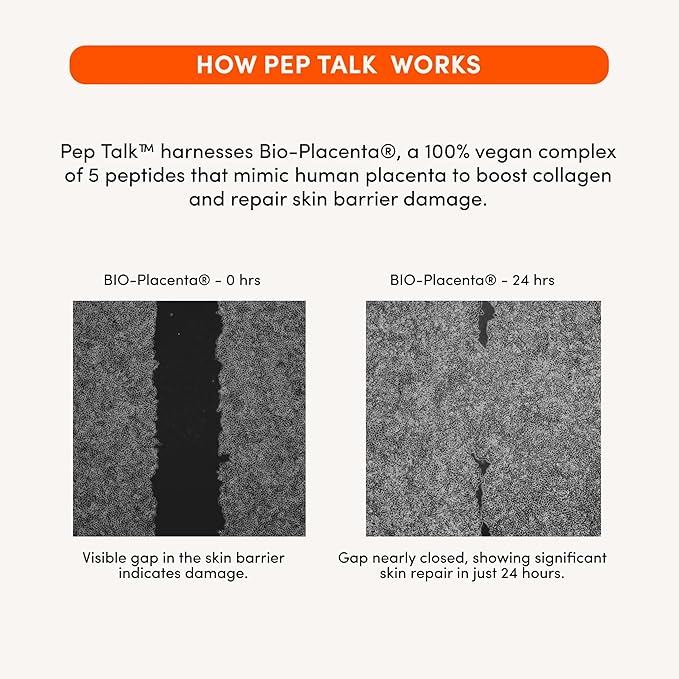Pep Talk Bio-Placenta Barrier Repair Cream for Redness & Dryness, Body and Face Moisturizer, Ceramide Barrier Repair Moisturizer Infused with Glutathione and Ashwagandha, 1.7 fl oz