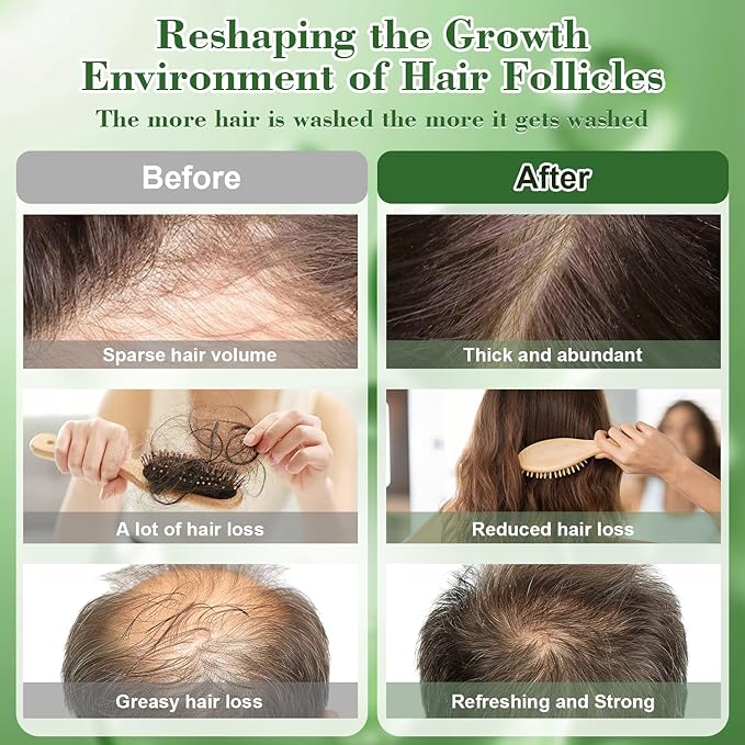 -Promote Hair Growth,Rosemary Shampoo,Nourishes Scalp, Reduces Breakage & Adds Shine,Reduces Hair Loss (Batana Shampoo-(10.1 fl oz))