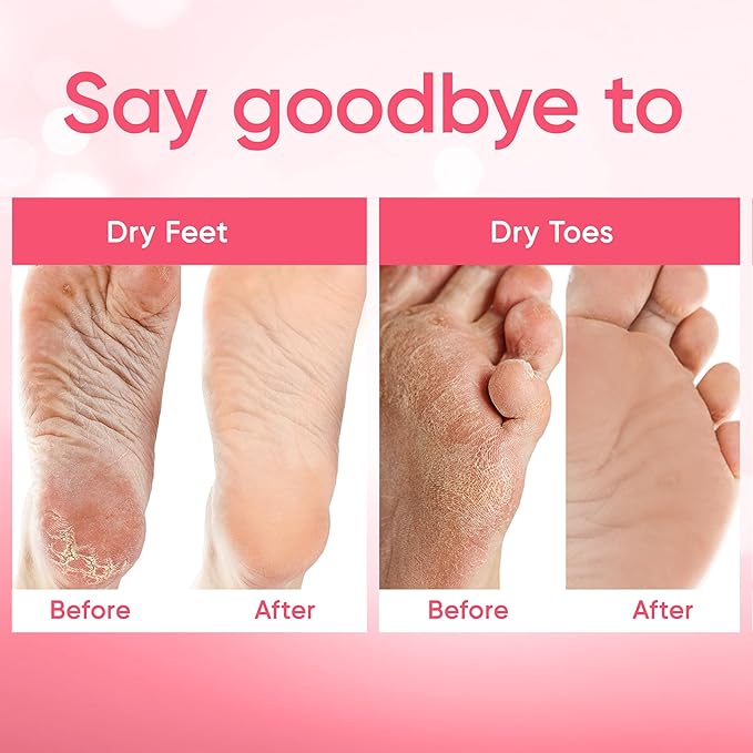 Foot Peel Mask - Foot Mask for Baby Soft Skin - Remove Dead Skin, Dry, Cracked Feet & Callus, Foot Spa, Made with Aloe Vera Extract for Women and Men (2 Pairs) | Strawberry & Aloe