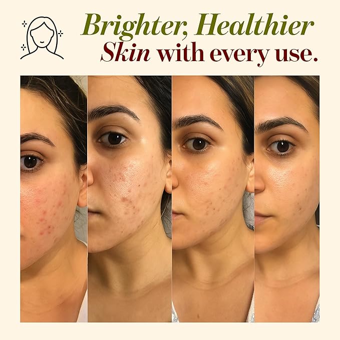 Multani Mitti Powder | Indian Healing Clay | 100% Pure Fullers Earth Powder for Natural Skin Tightening Face Mask | Deep Pores Cleansing | Bentonite Clay | Tan Removal Face Pack | 8 oz