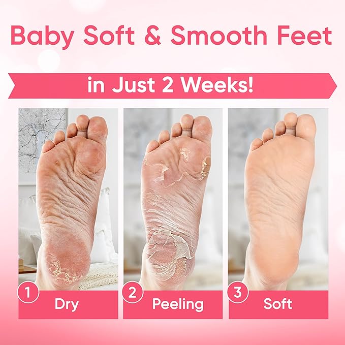 Foot Peel Mask - Foot Mask for Baby Soft Skin - Remove Dead Skin, Dry, Cracked Feet & Callus, Foot Spa, Made with Aloe Vera Extract for Women and Men (2 Pairs) | Strawberry & Aloe
