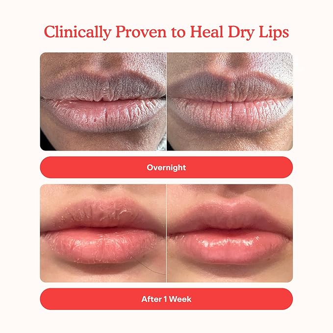 Tower 28 LipSoftie Tinted Lip Balm Treatment - Hydrating Glossy Balm + Overnight Lip Mask with Jojoba Oil + Shea Butter - Sweet, Cushiony Formula for Smooth, Soft Lips - Ube Vanilla (0.38 oz)