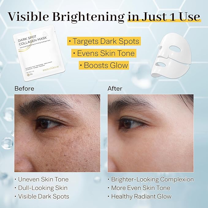 Overnight Collagen Face Mask – 4pk Hydrogel Korean Skincare for Glass Skin – Niacinamide Dark Spot Corrector & Pore Minimizer – Anti-Aging & Deep Hydration (0.88oz ea)
