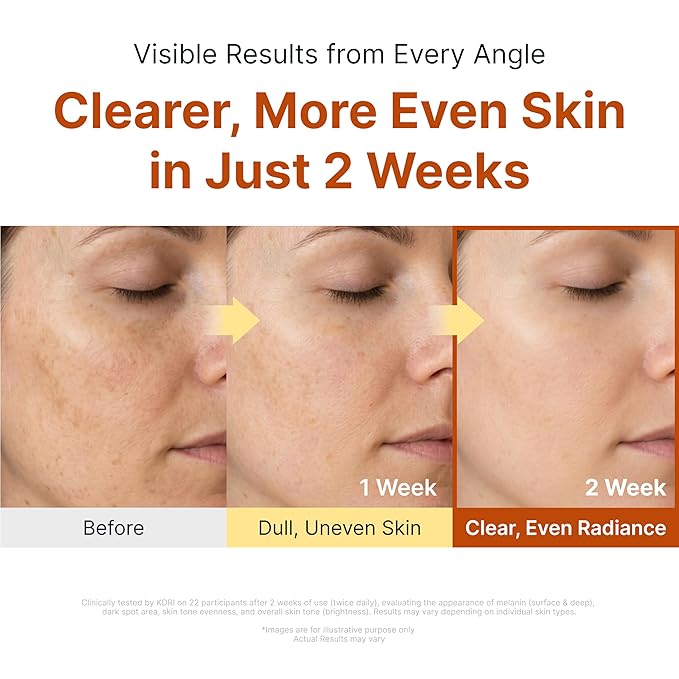 SUNGBOON EDITOR Glow Intensive Kojic Acid Ampoule, Radiance-Boosting Serum for Face with Kojic Acid, Turmeric & PHA l For Uneven Skin Tone & Dark Spot Care l Korean Skincare Serum, 1.35 fl oz