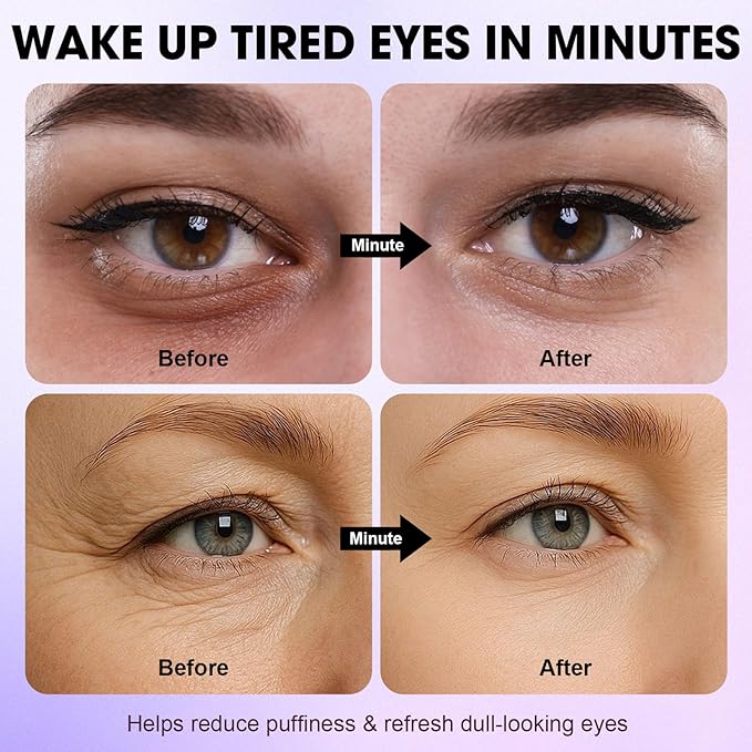 Caffeine Eye Cream for Puffiness & Dull Eyes, Helps Brighten & Smooth Under Eye Area, Lightweight Daily Eye Cream with Hyaluronic Acid for a Fresh, Well-Rested Look