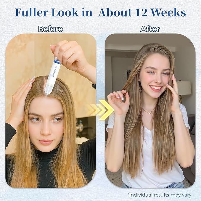 Hair Growth Serum Roll On with Rosemary，Helps Support Thicker, Fuller Hair Appearance，Clean, Non-Greasy Hair Loss Support for Men & Women，Saw Palmetto，0.84 Fl Oz (Pack of 2)