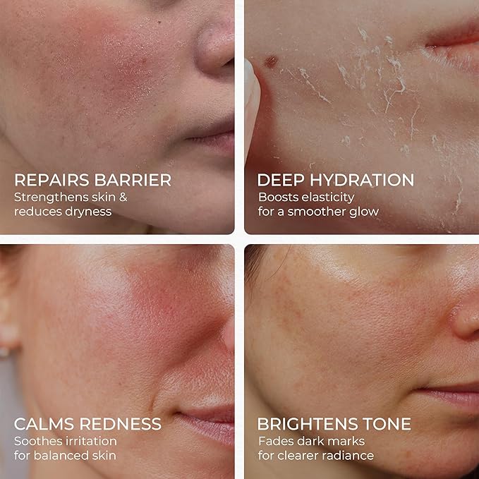 Organic Barrier Repair Face Serum – Brightening, Firming & Hydrating Serum for Dry & Sensitive Skin | Soothes Redness & Dryness | with Niacinamide, Vitamin E & Camelina Seed Oil