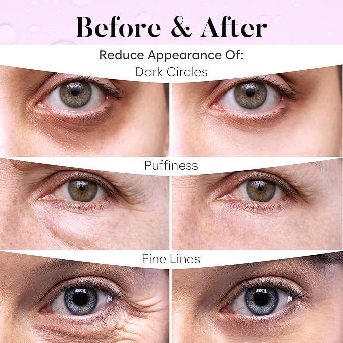 BLOOMORA PDRN, Caffeine & Collagen Under Eye Patches (30 Pairs), Under Eye Mask for Puffy Eyes, Appearance of Dark Circles, Smoothing & Hydration, Self Care & Skincare Gifts for Women, Patch Yeux