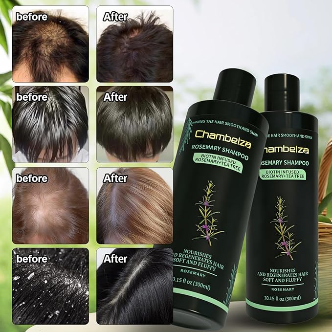 Organic Rosemary Hair Growth Shampoo for Men and Women-Natural Thickening and Strengthening Formula with Biotin Hydrolyzed keratin -Designed for Thinning Hair & Hair Loss 10.15 fl.oz