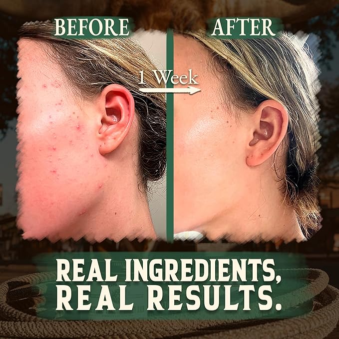 Organic Beef Tallow for Skin - 4 OZ (Eucalyptus) — US-Made Grass Fed Beef Tallow for Face + Body — Whipped Tallow and Honey Balm Moisturizer for Dry and Sensitive Skin, Eczema, Rosacea (No Additives)