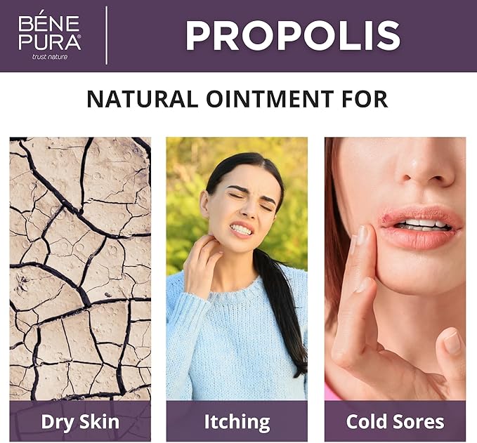 BenePura Propolis Ointment - Natural Anti Itch Cream with 30% Propolis - Itch Relief for Humans, Rash Cream - Multipurpose Moisturizing Propolis Cream for Dry Skin and Cracked Heel Repair - 1.35fl. Oz